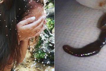 Mengerikan! Wanita Ini Menemukan Lintah Berukuran 5 Cm di Hidung Usai Membasuh Wajah dengan Aliran Air di Gunung