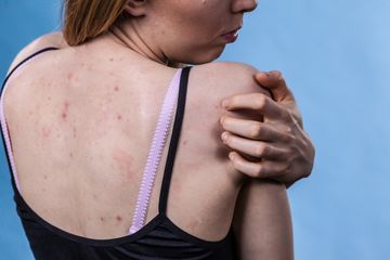 Cara Menghilangkan Daki di Badan dengan Benar, Perhatikan Kandungan Lulur