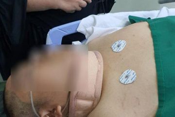 Pendarahan di Otak, Seorang Mahasiswa Pendemo Kritis di RS Pelni Usai Ditemukan Bersimbah Darah