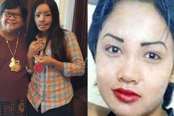 Kabar terkini Lisa setelah 14 tahun berlalu pasca wajahnya disiram air keras oleh suaminya sendiri