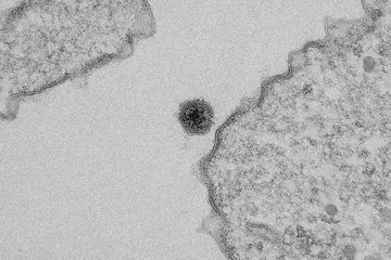 Temuan Yara Virus baru yang memiliki karakteristik yang berbeda dari virus-virus yang ada sebelumnya.