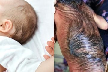 Bayi ini Dilahirkan dalam Kondisi Tak Lazim Hingga Membuat Ruangan Operasi Gempar, Orang Tua ini Justru Berikan Reaksi Tak Terduga dengan Konsidi Fisik Anaknya