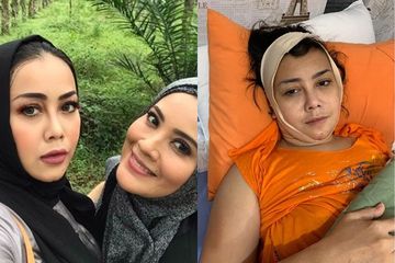 Rency Milano Diduga Jadi Korban Malpraktik Klinik Kecantikan, Dagu dan Bibirnya Keluarkan Cairan Pekat