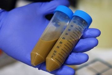 Efek Transplantasi Tinja pada Pasien COVID-19 Akan Diuji Klinis