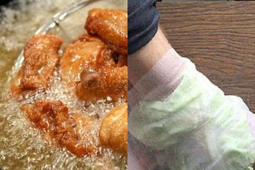 BERITA POPULER : Dari Jangan Lagi Makan Ayam Kalau Masih Digoreng dengan Cara Ini sampai Coba Tempel Sayur Kol ke Telapak Kaki Sebelum Tidur