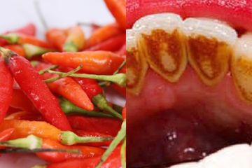 BERITA POPULER : Dari Simpan Cabai dengan Cara Ini supaya Awet sampai Cara Merontokkan Karang Gigi Sendiri dengan Bahan Dapur