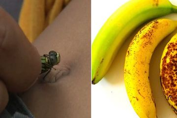 Duh, Yakin Hari Gini Masih Pakai Capung Di Pusar Biar Tidak Ngompol? Coba Minta Si Kecil Makan Pisang Sebelum Tidur, Bye Bye Kasur Basah