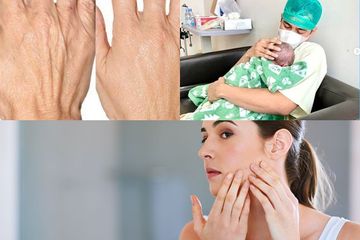 Berita Terpopuler: 11 Cara Menghilangkan Keriput di Tangan Pakai Bahan Alami hingga Baking Soda untuk Atasi Warna Kulit Tidak Merata