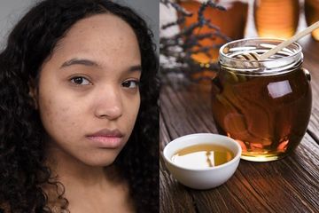 Gak Pernah Ke Klinik Kecantikan Tapi Wajahnya Mulus, Ternyata Tetangga Rajin Pakai Masker Madu dan Campuran Ini untuk Hempas Flek Hitam Di Wajah
