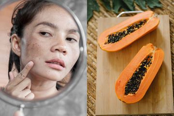 menghilangkan flek hitam