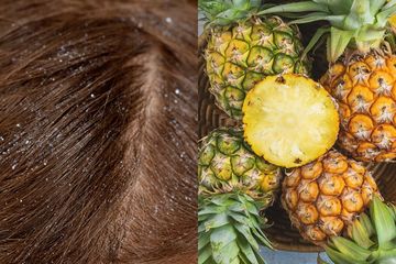Rambut berketombe kini bisa Anda atasi dengan menggunakan buah nanas yang sering Anda beli di pasar.