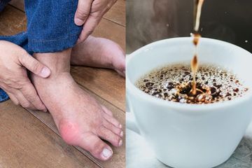 Makanan Penyebab Asam Urat, Benarkah Minum Kopi dari Muda Bisa Bikin Tua Nanti Derita Asam Urat nan Menyakitkan?