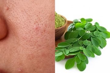 Dibilang Gak Modal Gegara Gak Pakai Skincare, Padahal Mau Punya Wajah Mulus Tanpa Pori-Pori Bisa Pakai Daun Kelor, Coba dan Buktikan Hasilnya!