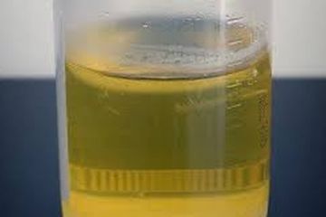Warna urin berwarna kuning disebabkan oleh pigmen urokrom, juga dikenal sebagai urobilin.
