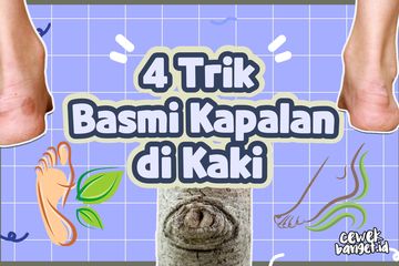 4 Trik Basmi Kapalan di Kaki