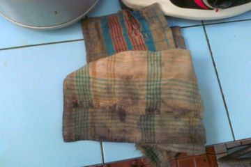 Berbulan-bulan Dibiarkan Kotor, Kain Serbet yang Dekil Bisa Kinclong Lagi dengan 2 Bahan Rumahan Saja, Ampuh Deh!