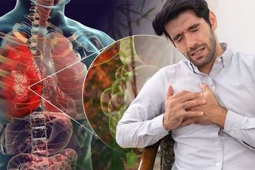 Spesies Baru Bakteri Penyakit Pneumonia Misterius Ditemukan di Italia