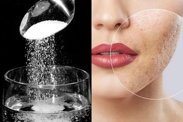 Mahal-mahal Pakai Skincare, Bopeng Menahun di Wajah Bisa Hilang Cuma Modal Air Garam, Begini Cara Pakainya Supaya Ampuh