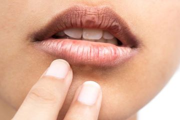 Memerahkan Bibir Hitam Ternyata Gampang, Oles 5 Bahan Alami Ini Secara Rutin
