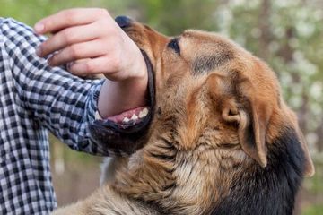 Wabah rabies di masa lalu telah dikaitkan dengan cerita rakyat manusia serigala.