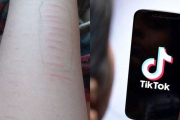 Jangan Sampai Anak Lihat! Viral Bocah SD Sayat-Sayat Tangan di TikTok, Orang Tua Kenali Bahayanya