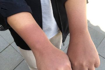 Tanpa Skincare! 5 Bahan Alami Ini Ternyata Ampuh Menghilangkan Kulit Tangan Belang Setelah Motoran