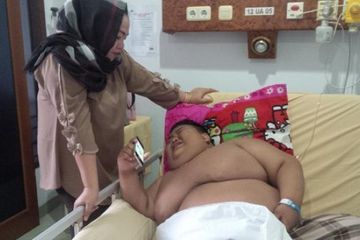Setelah Arya, Ini Kisah Rizki Bocah 11 Tahun dengan Bobot 119 Kilogram