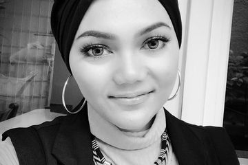 Rina Nose Sambangi Klinik Kecantikan Usai Dibilang Pesek, yang Dilakukannya Tak Disangka-sangka