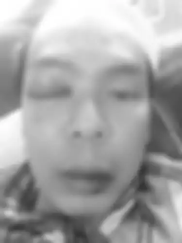 Foto Ryan Jombang usai dibogem Habib Bahar bin Smith bikin syok. 