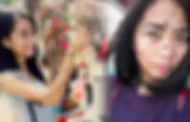Masih Ingat Evita Delmundo yang Dulu Dijuluki Monster Gegara Tubuhnya Dipenuhi Tahi Lalat, Begini Kondisinya Sekarang
