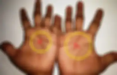 Cek Tangan Anda  Apakah Memiliki Tanda X yang Langka Ini?  Inilah Arti Tanda Tersebut
