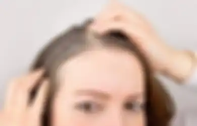 Ini 5 Bahan Alami Penghilang Rambut Beruban. Cepat dan Praktis!