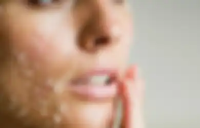Bukannya Bikin Mulus, 7 Produk Skincare Ini Malah Bisa Merusak Kulit!