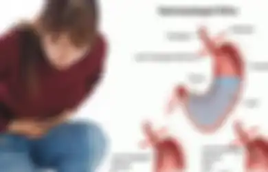 Satu Indonesia Harus Tahu, Asam Lambung Rendah Juga Berbahaya Bagi Kesehatan, Ini Gejala dan Cara Mengatasinya Secara Alami