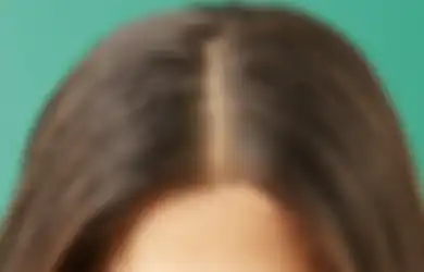 Rambut Kering dan Ketombe? Ini Rekomendasi Sampo Anti Ketombe Terbaik