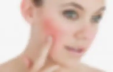 Murah Meriah, Ini 5 Skincare Pagi Jagoan Buat Kulit Sensitif Kemerahan
