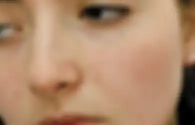 5 Penyebab Munculnya Noda dan Bintik-Bintik di Wajah. Enggak Flawless!