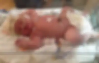 Lahirkan Bayi Seberat Hampir 7 Kilogram, Sang Ibu Ceritakan Proses Melahirkan: Saya Merasa Seperti Dihantam Dua Truk Trailer
