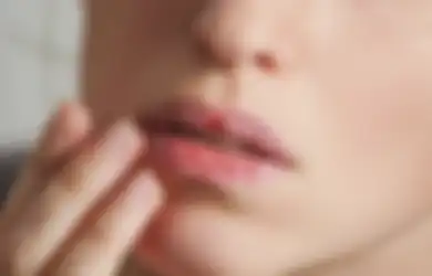 5 Cara Atasi Bibir Kering karena Cuaca Panas. Minum Air Enggak Cukup!