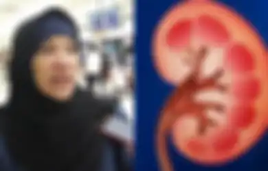 Dorce Gamalama Idap Batu Ginjal: Ternyata Obat Batu Ginjal Ada di Rumah, Salah Satunya Air Cuka