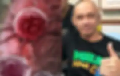BREAKING NEWS: Agung Hercules Tutup Usia Hari Ini Pukul 16.00 WIB