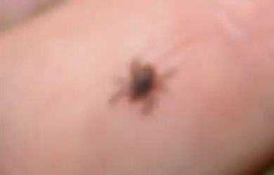 Cuma Pakai Lotion Anti Nyamuk, Siapa Sangka Bisa Hilangkan Kutu Kasur Dalam Semalam, Menyesal Baru Tahu!