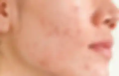 Enggak Jadi Mulus, 5 Kebiasaan Skincare Ini Bikin Kulit Makin Rusak!