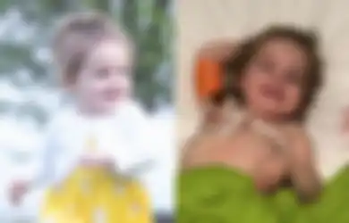Baru Berusia 2 Tahun, Bocah Cantik Ini Terserang Penyakit Misterius, Hanya Bisa Hidup dengan Menjadi 'Vampir'