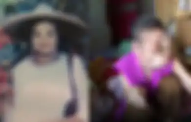 Berawal dari Kebiasaan Memencet Jerawat, Wanita ini Harus Telan Pil Pahit Karena Wajahnya Hancur Hingga Tak Bisa Dikenali
