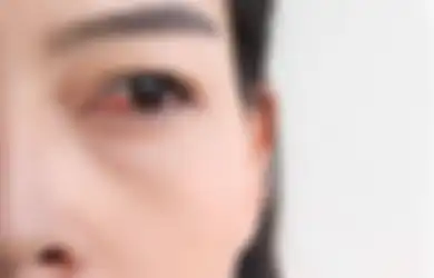 Bingung Mata Perih Tiba-tiba? 5 Hal Ini Bisa Jadi Penyebabnya, Lho!