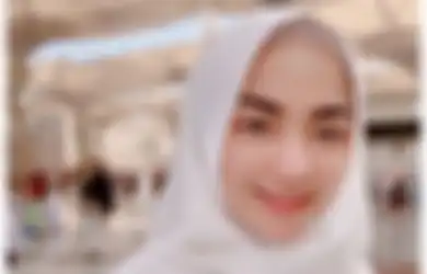 Rambutnya Kini Botak, Imel Putri Tak Menyerah dengan Penyakit Ganas yang Gerogoti Tubuhnya, Curhatan Janda Sirajuddin Mahmud Jadi Sorotan