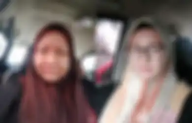 Hanya Bisa Terima Nasib, Wajah Perempuan Ini Berubah Menakutkan Saat Hamil, Tak Berani Keluar Rumah: Saya Hanya Bisa Tersenyum, Tapi dalam Hati Hancur Lebur