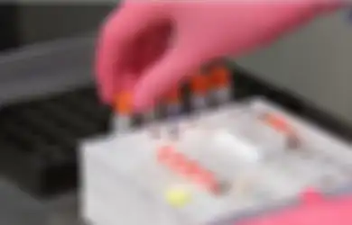Modal Obat Racikan Jepang, Rusia Klaim Berhasil Temukan Vaksin Corona Paling Menjanjikan di Dunia, Arab Saudi Jadi yang Pertama Dapat Jatah