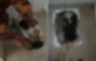 Kepleset, Wanita Ini Terperosok Masuk ke Dalam Jamban hingga Sedada